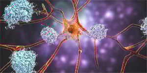 illustration_Amyloid-Beta