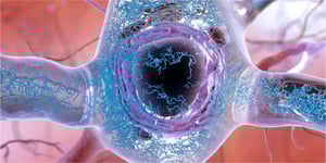 illustration_Tau-Pathology